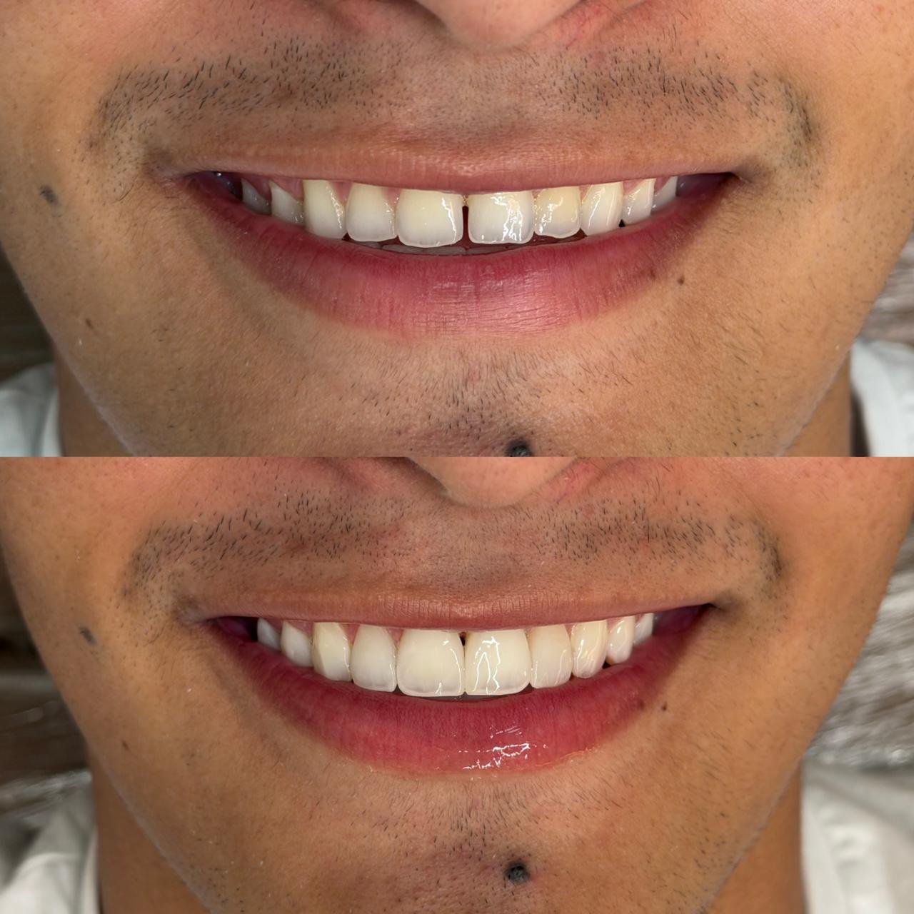 Projeto Bucalle 8