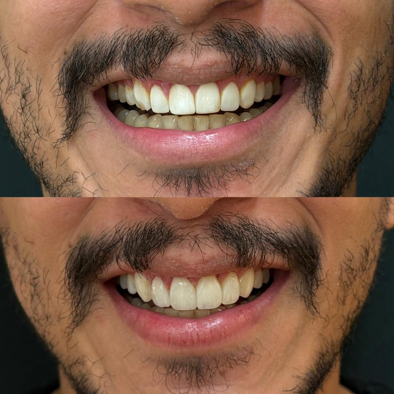 Projeto Bucalle 9